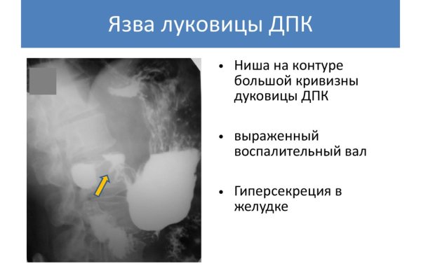 Ссылка кракен официальная тор